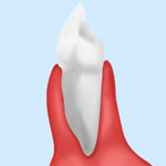 スターデンタルクリニックの歯周病治療